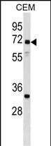 WB - NPLOC4 Antibody (C-term) AP17356b