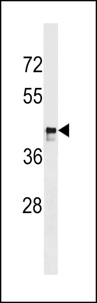 WB - MARCH9 Antibody (C-term) AP17367b