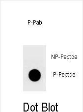 Dot blot analysis of Phospho-YAP-S127 antibody Phospho-specific Pab (Cat. #AP3769a) on nitrocellulose membrane. 50ng of Phospho-peptide or Non Phospho-peptide per dot were adsorbed. Antibody working concentrations are 0.6ug per ml.
