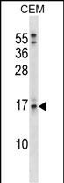 WB - SOSTDC1 Antibody (C-term) AP17397b