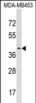 WB - PAFAH2 Antibody (Center) AP17398c