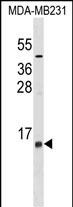 WB - LST1 Antibody (Center) AP17403c