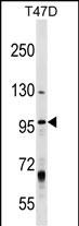 WB - MCM8 Antibody (Center) AP17408c