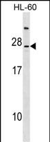 LY96 Antibody (C-term) (Cat. #AP17412b) western blot analysis in HL-60 cell line lysates (35ug/lane).This demonstrates the LY96 antibody detected the LY96 protein (arrow).