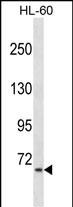 AKAP8L Antibody (C-term) (Cat. #AP17416b) western blot analysis in HL-60 cell line lysates (35ug/lane).This demonstrates the AKAP8L antibody detected the AKAP8L protein (arrow).