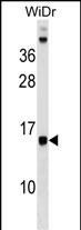 DAD1 Antibody (C-term) (Cat. #AP17433b) western blot analysis in WiDr cell line lysates (35ug/lane).This demonstrates the DAD1 antibody detected the DAD1 protein (arrow).