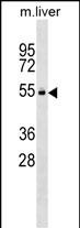 WB - Mouse Vrk2 Antibody (C-term) AP17443b