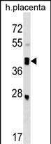 WB - SMOC2 Antibody (C-term) AP17464b