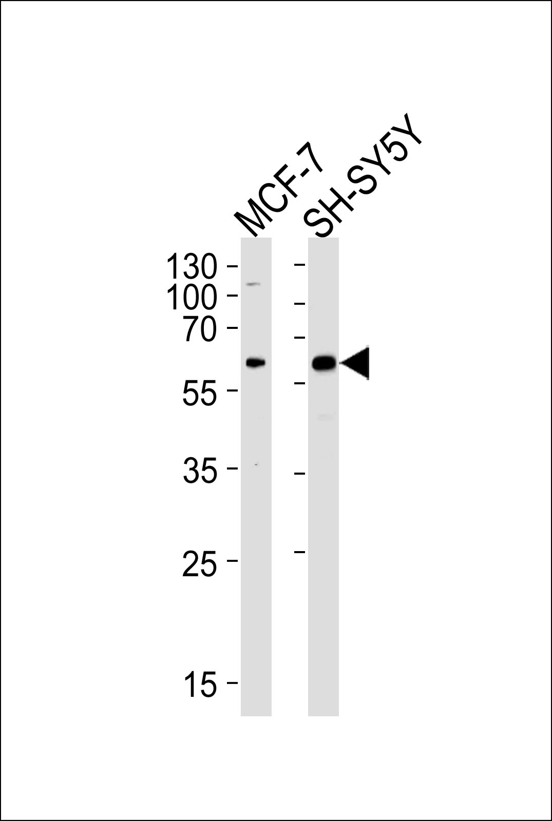 WB - ZBTB22 Antibody (C-term) AP17466b