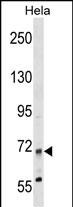 WB - MTMR14 Antibody (N-term) AP17472a