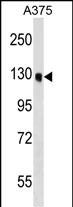 WB - OSBPL6 Antibody (C-term) AP17475b