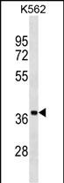 WB - UBLCP1 Antibody (C-term) AP17480b