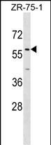WB - ZNF10 Antibody (N-term) AP17496a