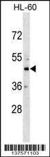 WB - CHST10 Antibody (C-term) AP17499B