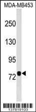 AOPEP Antibody (N-term) (Cat. #AP17505a) western blot analysis in MDA-MB453 cell line lysates (35ug/lane).This demonstrates the AOPEP antibody detected the AOPEP protein (arrow).