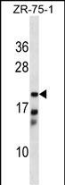 WB - CBR4 Antibody (C-term) AP17512B