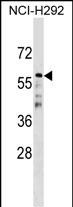 CDC20B Antibody (N-term) (Cat. #AP17515a) western blot analysis in NCI-H292 cell line lysates (35ug/lane).This demonstrates the CDC20B antibody detected the CDC20B protein (arrow).