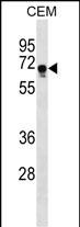 WB - FEM1C Antibody (C-term) AP17534b