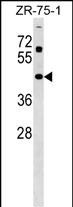 WB - ZNF323 Antibody (Center) AP17548c