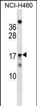 WB - MRPS11 Antibody (Center) AP17559C