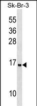 WB - UTS2D Antibody (N-term) AP17577A