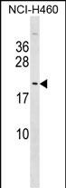 WB - TTDN1 Antibody (C-term) AP17580b