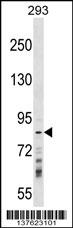 WB - RNF219 Antibody (Center) AP17601C