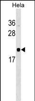 WB - RWDD1 Antibody (N-term) AP17604a