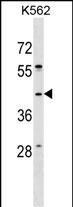 WB - SPO11 Antibody (C-term) AP17609b