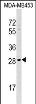 AIDA Antibody (C-term) (Cat. #AP17627b) western blot analysis in MDA-MB453 cell line lysates (35ug/lane).This demonstrates the AIDA antibody detected the AIDA protein (arrow).
