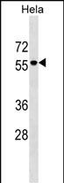 WB - AMIGO3 Antibody (Center) AP17628C