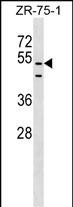 WB - PDZD3 Antibody (Center) AP17639c