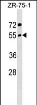 ARCN1 Antibody (Center) (Cat. #AP17651c) western blot analysis in ZR-75-1 cell line lysates (35ug/lane).This demonstrates the ARCN1 antibody detected the ARCN1 protein (arrow).