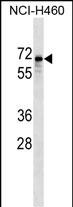 WB - SNTB1 Antibody (Center) AP17655c