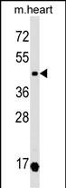 WB - OXTR Antibody (N-term) AP17658a