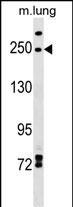 WB - INF2 Antibody (Center) AP17660c