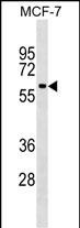 WB - SHOC2 Antibody (N-term) AP17667a