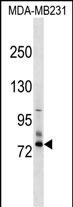 WB - SCNN1D Antibody (N-term) AP17675A