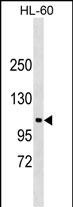 WB - NDST3 Antibody (C-term) AP17676B
