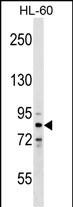 WB - ZNF224 Antibody (N-term) AP17677A