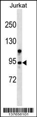 WB - ZMYM6 Antibody (N-term) AP17680a