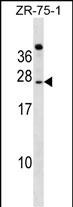WB - IGSF6 Antibody (Center) AP17688c