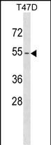 WB - KRT79 Antibody (Center) AP17691C