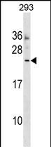 WB - MOSPD3 Antibody (Center) AP17696c