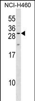 WB - MPZL2 Antibody (Center) AP17697c