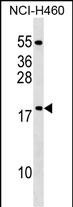 WB - MRPL54 Antibody (Center) AP17698c