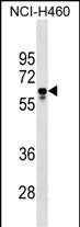 WB - PGS1 Antibody (Center) AP17706c