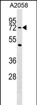 WB - PHF19 Antibody (C-term) AP17707b