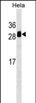 WB - TMED1 Antibody (Center) AP17714c