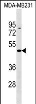WB - ZBTB25 Antibody (C-term) AP17719b